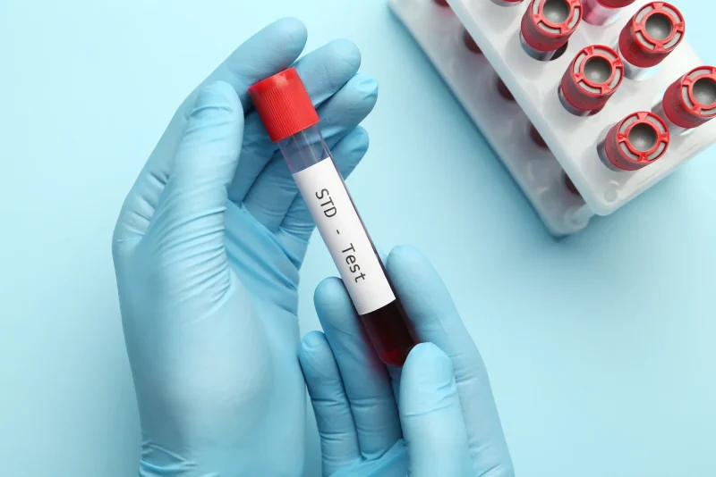 Sexually Transmitted Diseases and At-Home Testing